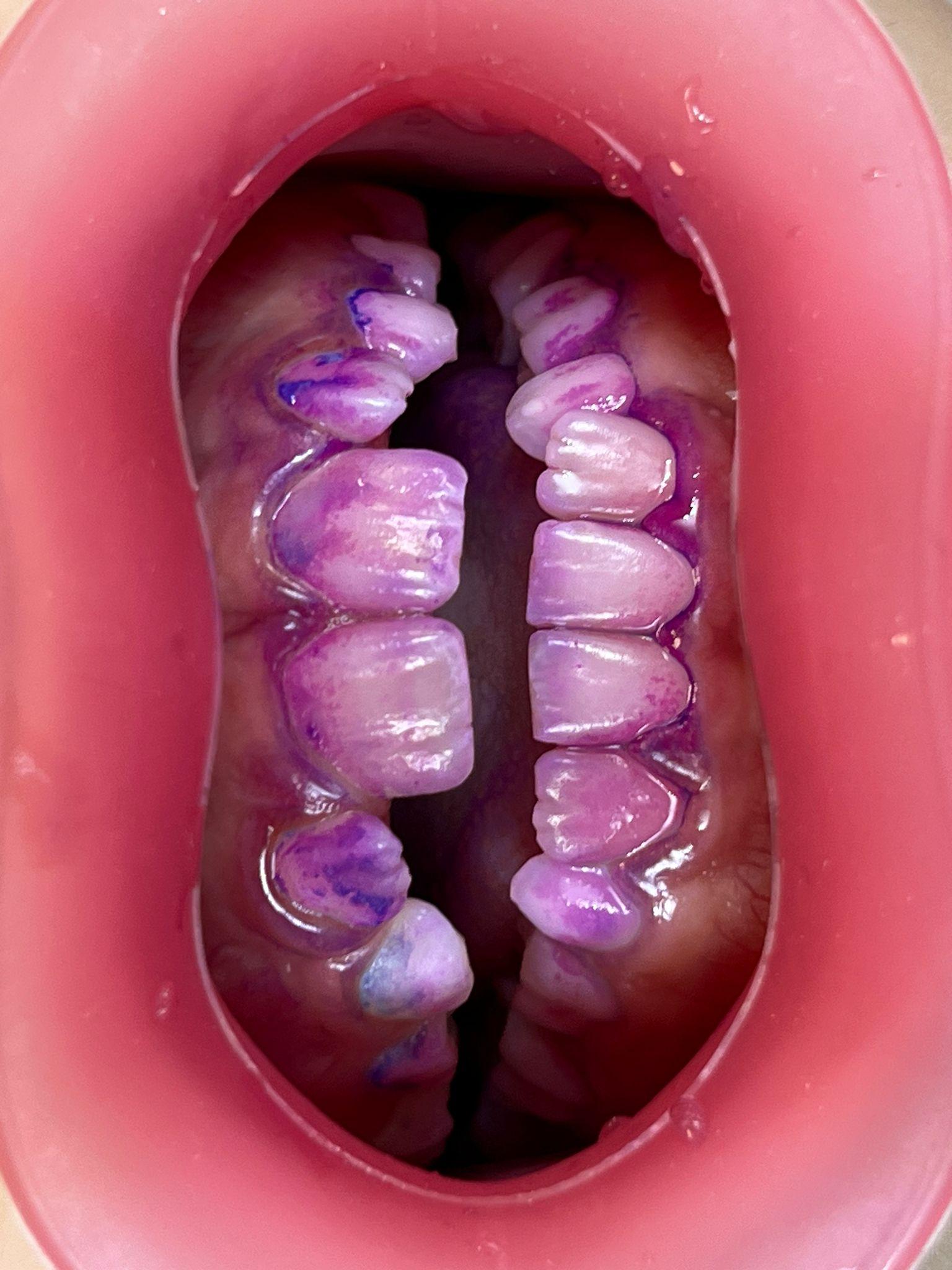 Intraoral Dental Photography: A Practical Guide for the Modern Practice