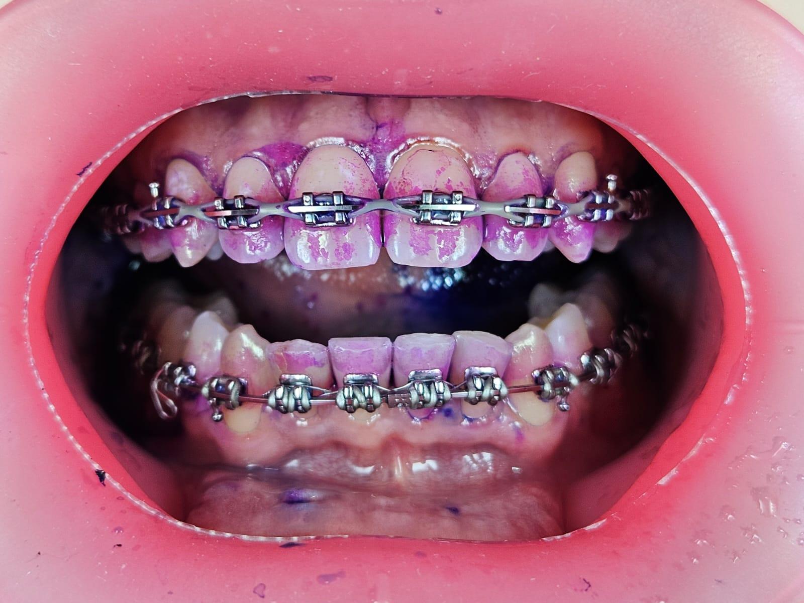 Orthodontic photography